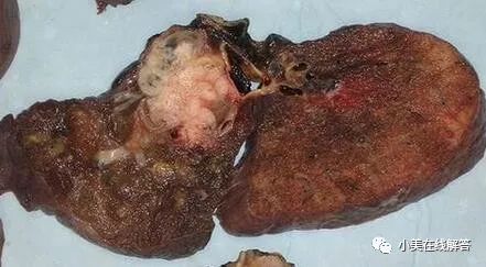 服用硒维康有副作用吗(服用副作用硒维康有副作用吗)-硒宝网