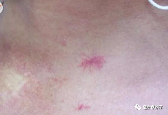 硒维康吃时间长了掉发(服硒维康时间长身体有啥症状)-硒宝网