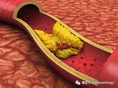 硒维康糖尿病可以吃吗（糖尿病人能吃硒）-硒宝网