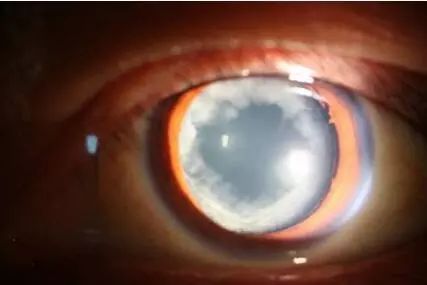 硒维康都什么人可以用(硒维康适合什么人吃)-硒宝网