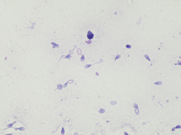 锌硒宝 吃多久 检查(锌硒宝可以吞服吗)-硒宝网