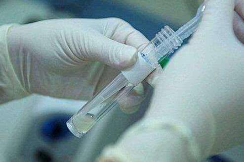 提高精子质量吃锌硒宝（弱精吃锌硒宝）-硒宝网