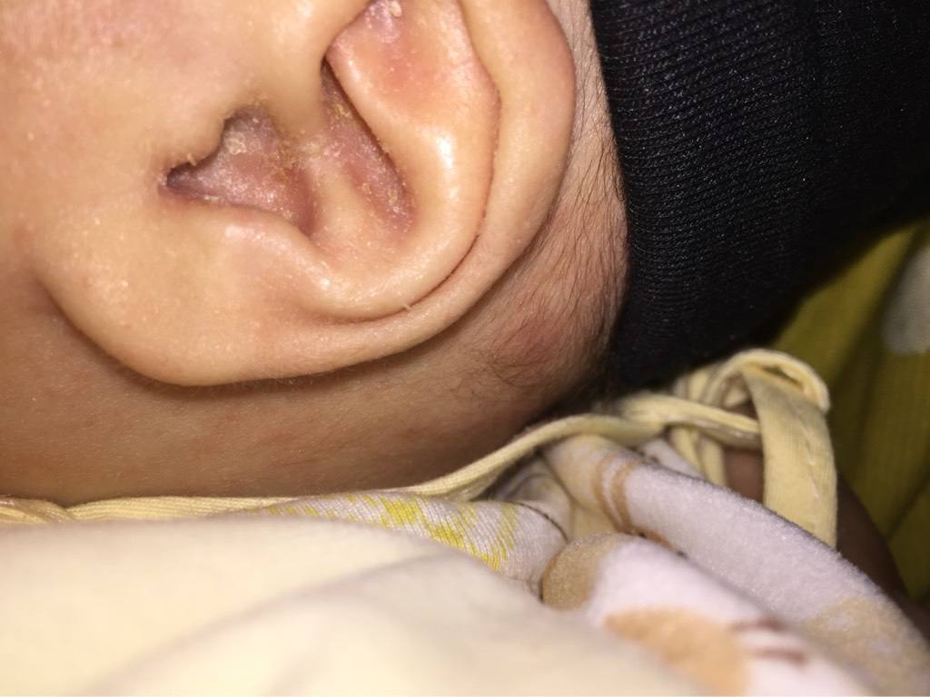 hpv患者吃锌硒宝片（锌硒宝片能抵抗hpv吗）-硒宝网