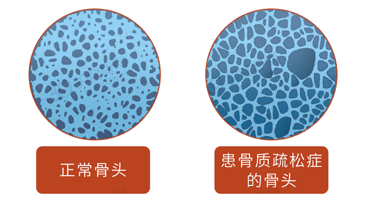 50岁女士补钙哪种钙片好（女士补钙哪种好）-硒宝网