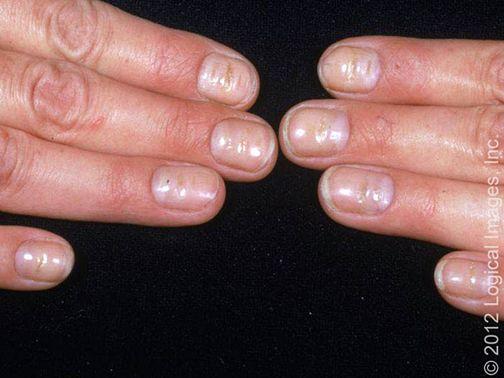 微量元素检查挂哪个科(挂微量科元素检查要多少钱)-硒宝网