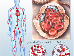 补铁口服液(口服液补铁快还是药片)-硒宝网