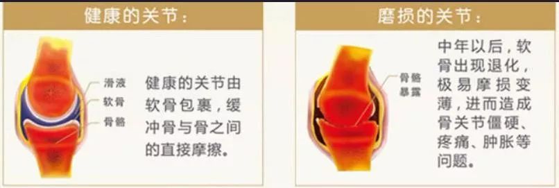 60岁老人补钙哪个牌子好(牌子补钙老人好的有哪些)-硒宝网