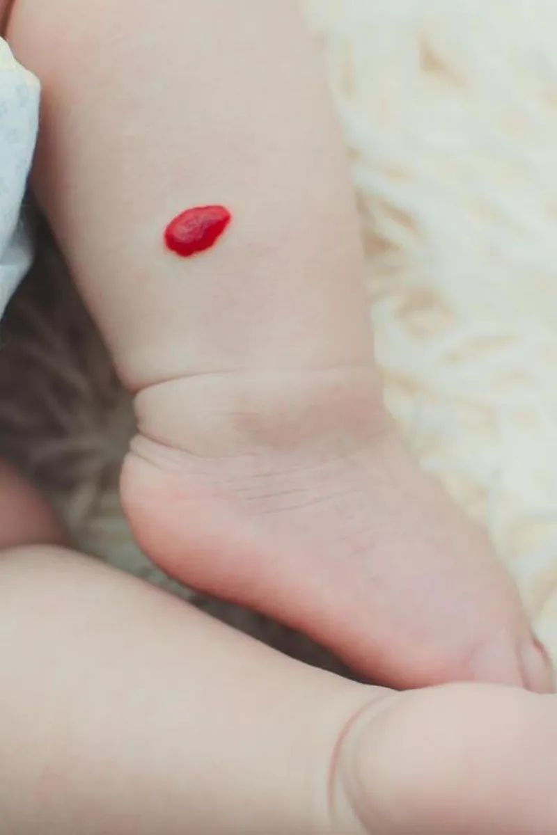 荨麻疹能吃锌硒宝片吗（荨麻疹吃锌有用吗）-硒宝网