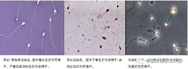 备孕时男性吃锌硒宝片（备孕男的吃锌硒片）-硒宝网