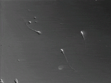 乙肝肝硬化患者怎么补硒(肝硬化补患者乙肝硒片吃多久)-硒宝网