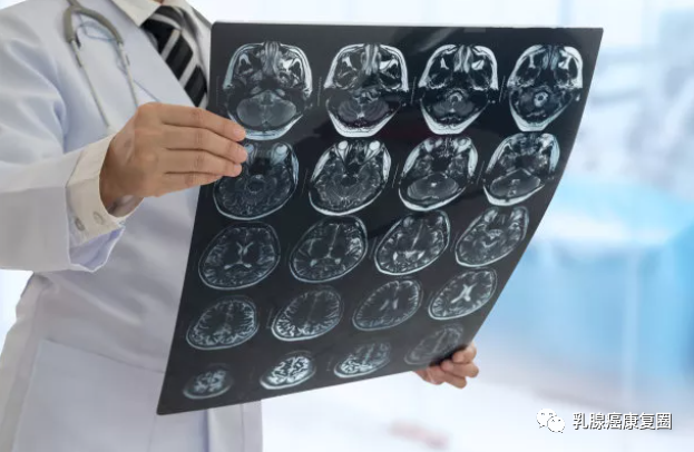 管状腺瘤切除可以补硒吗(管状腺瘤切除后需要服用药物吗)-硒宝网