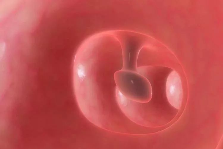 管状腺瘤切除可以补硒吗（管状腺瘤切除后多久可以喝酒）-硒宝网