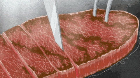 普通人每天补多少硒元素（每天补元素普通硒人吃多少）-硒宝网