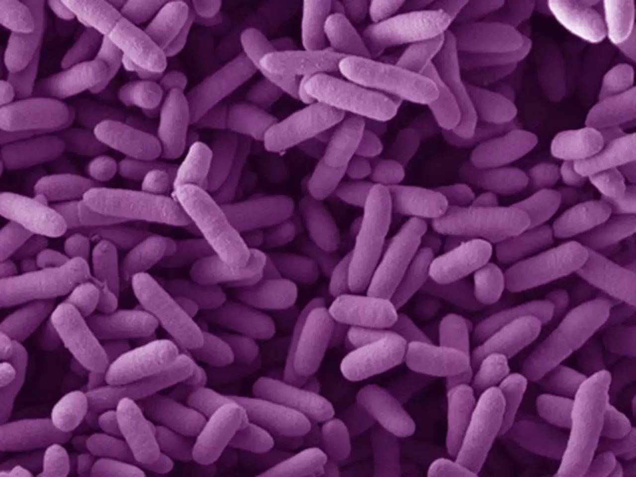 胰腺癌患者补硒康复时间（胰腺癌可以吃硒酵母片吗）-硒宝网