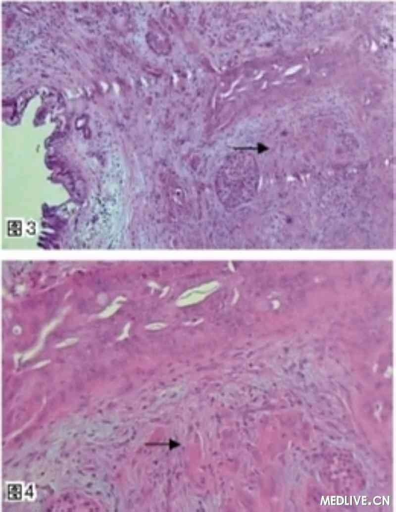 胰腺癌患者补硒康复时间（胰腺癌可以吃硒酵母片吗）-硒宝网