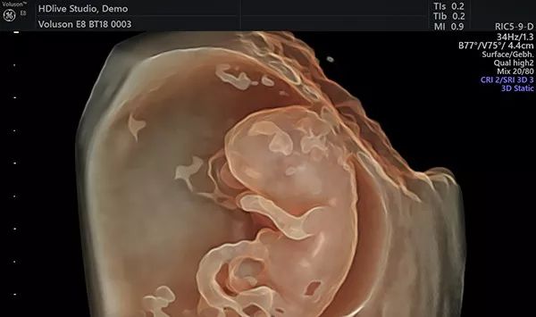 贫血吃钙铁锌硒补得好吗(钙锌贫血补铁吃得多久)-硒宝网