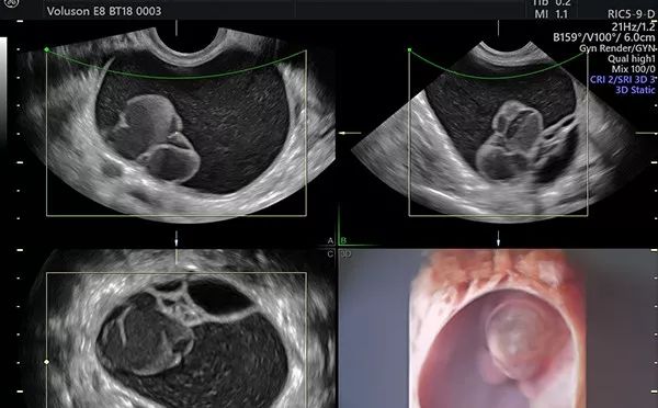 贫血吃钙铁锌硒补得好吗(钙锌贫血补铁吃得多久)-硒宝网
