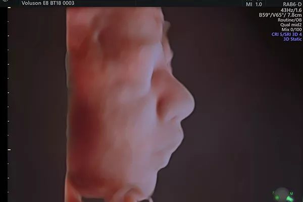 贫血吃钙铁锌硒补得好吗(钙锌贫血补铁吃得多久)-硒宝网