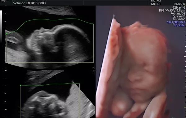 贫血吃钙铁锌硒补得好吗(钙锌贫血补铁吃得多久)-硒宝网