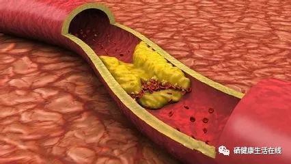 糖尿病高血压补硒的好处（高血压糖尿病是缺硒导致的吗）-硒宝网