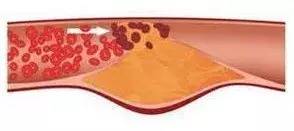 补硒可以吃补药能补硒吗(补硒期间可以喝酒吗)-硒宝网