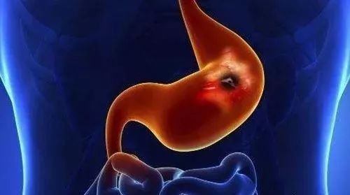 吃确立硒酵母可以补硒吗（补充酵母硒会有什么不适）-硒宝网