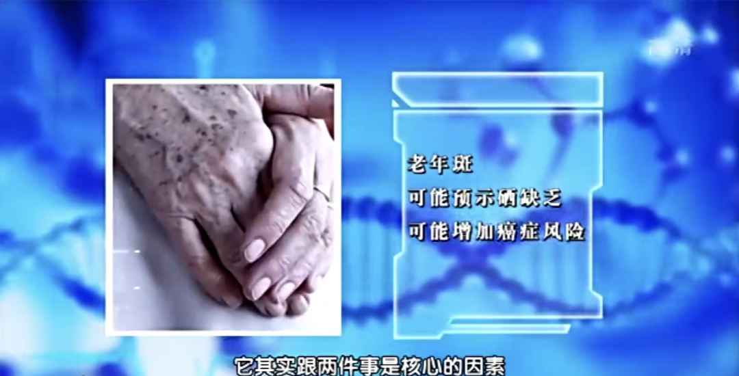 人体缺硒怎么办如何补硒(人体缺硒用什么补)-硒宝网