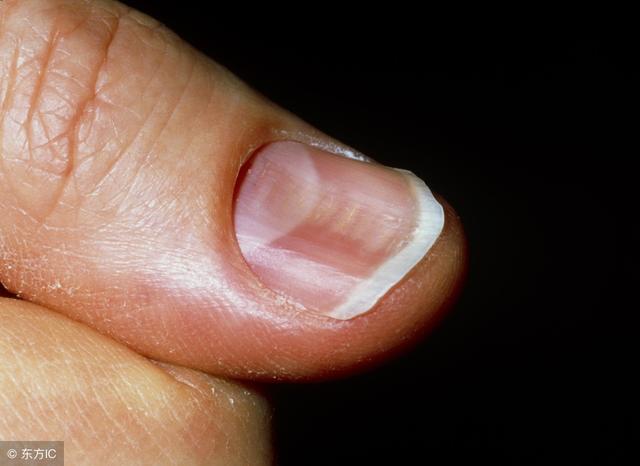 肝病患者如何科学补硒硒(补硒肝脏)-硒宝网