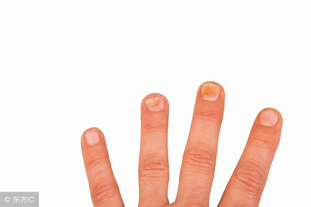 肝病患者如何科学补硒硒(补硒肝脏)-硒宝网