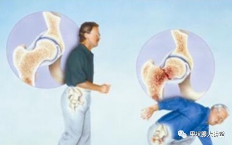 单纯甲减要补硒吗怎么补(补单纯硒要甲减吃什么)-硒宝网