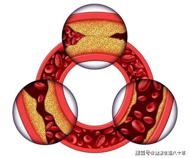 补硒过多身体有什么症状(补硒过度会硒中毒吗)-硒宝网