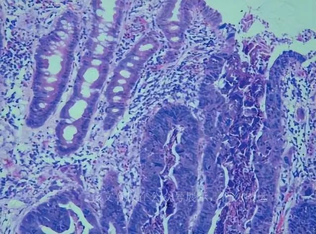 人体硒吃什么食物补最好（吃硒补什么）-硒宝网