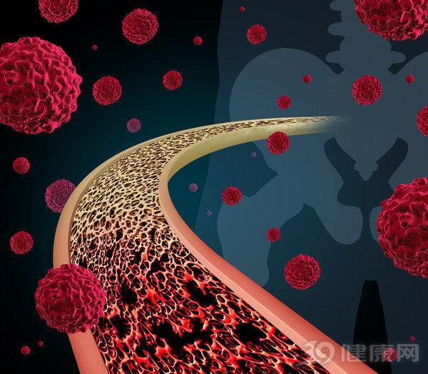 补硒真的让肿瘤消失了吗(肿瘤病人补硒疗效案例)-硒宝网