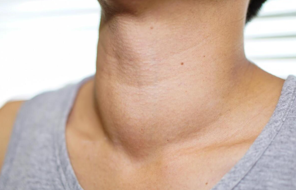 什么水果食物补硒效果好（哪些水果补硒）-硒宝网