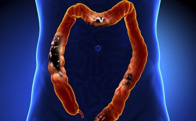 补硒后有些什么调理反应（补硒的好转反应）-硒宝网