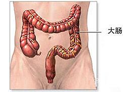 结肠腺癌中晚期补硒好吗（结肠癌可以吃硒吗）-硒宝网