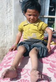 为什么有人宣传补硒食品（补硒食品）-硒宝网