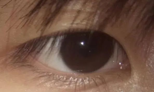 吃什么食物补硒元素最好（补充硒元素的好处）-硒宝网