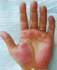 吃什么食物补硒元素最好（补充硒元素的好处）-硒宝网