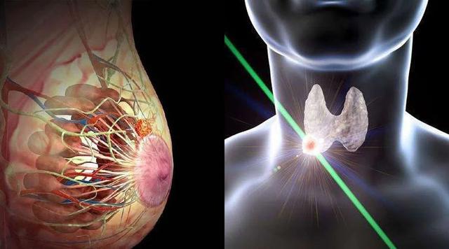 补硒会影响甲状腺嘛女性(甲状腺问题补硒会不会过量)-硒宝网