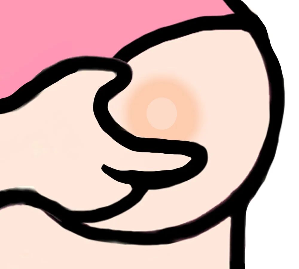 补硒导致乳腺增生加重吗（乳腺增生可以吃硒片吗）-硒宝网