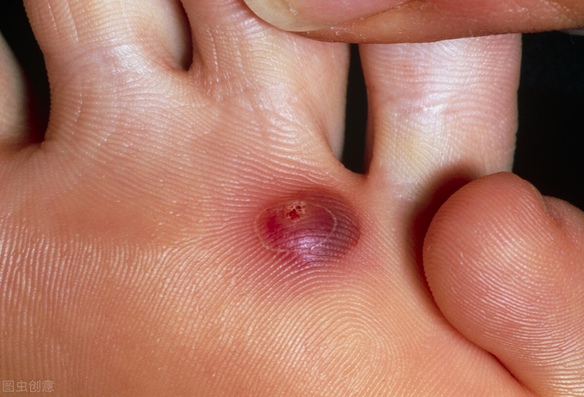 过量补硒脱发方法是什么(补硒掉头发还会生长出来吗)-硒宝网