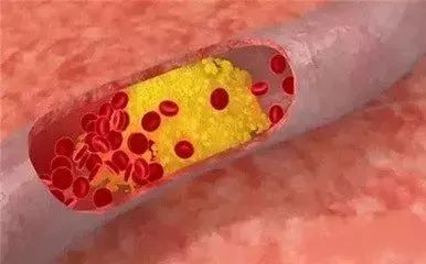 中老年如何补硒减肥最好（硒对中老年人的好处）-硒宝网