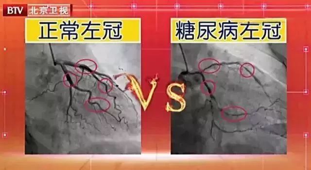 中老年如何补硒减肥最好（硒对中老年人的好处）-硒宝网