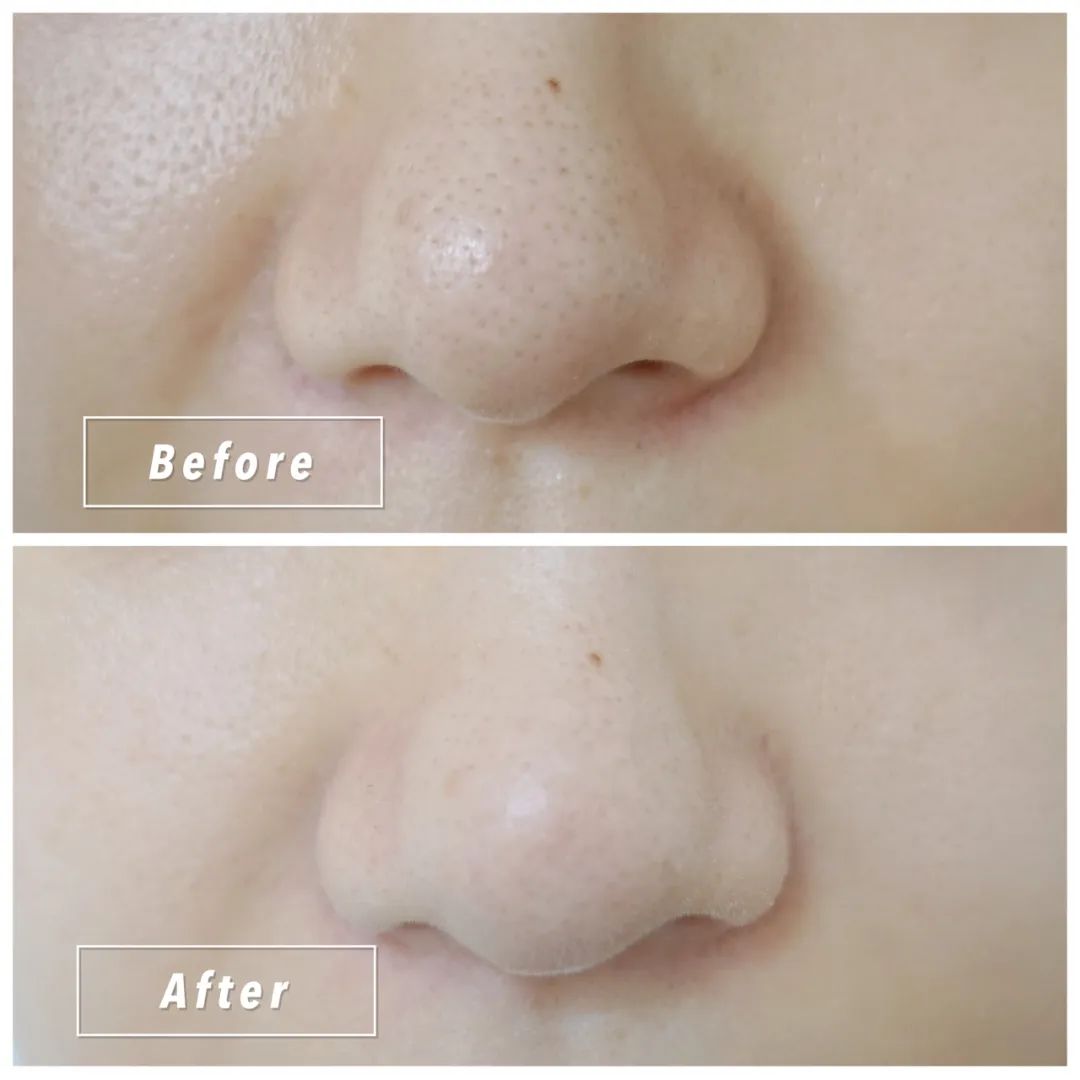 补硒海鲜推荐哪个品牌好（哪种海鲜含硒元素最多）-硒宝网