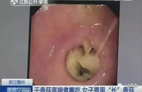 癌症患者补硒真的管用吗（癌症补硒）-硒宝网