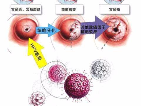 hpv治好了需要补硒吗（得了hpv补硒）-硒宝网