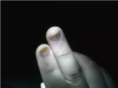 平时吃饭补硒吗好吗女性（女生补硒有什么好处）-硒宝网