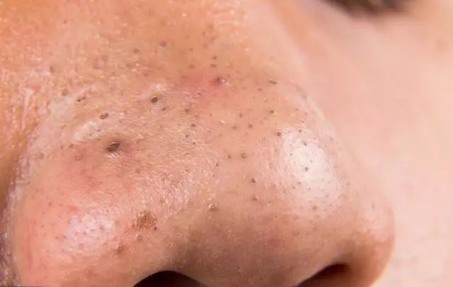 平时吃饭补硒吗好吗女性（女生补硒有什么好处）-硒宝网