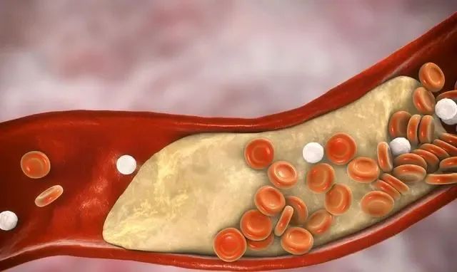 补硒过量导致胆固醇升高(摄入高胆固醇的会长胖吗)-硒宝网